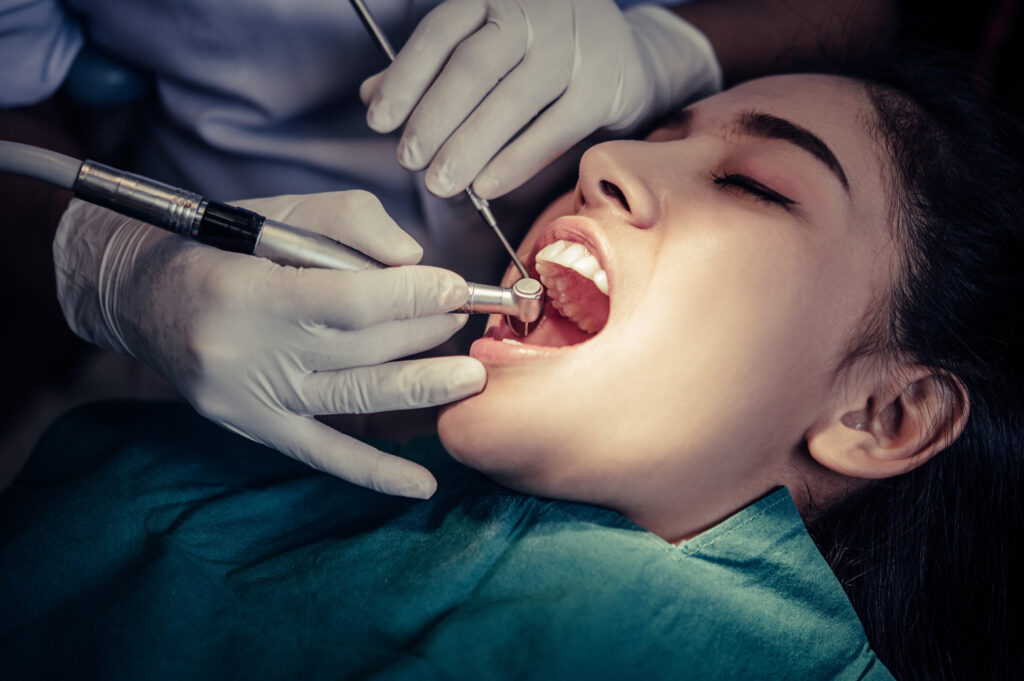 Teeth Cleaning Services in Naranpura