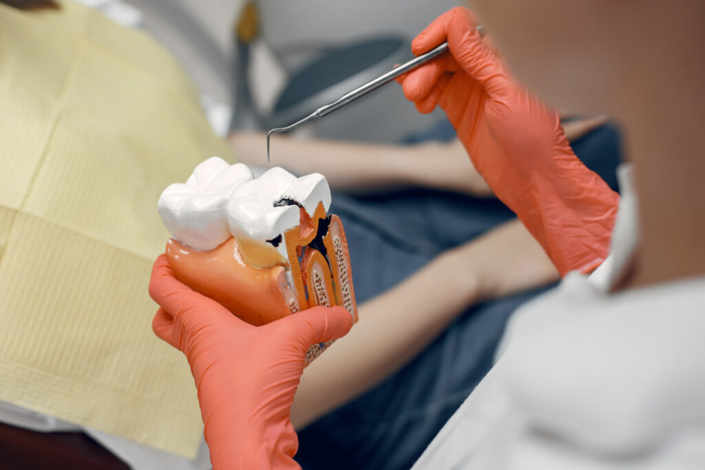 Root Canal Treatment in Naranpura
